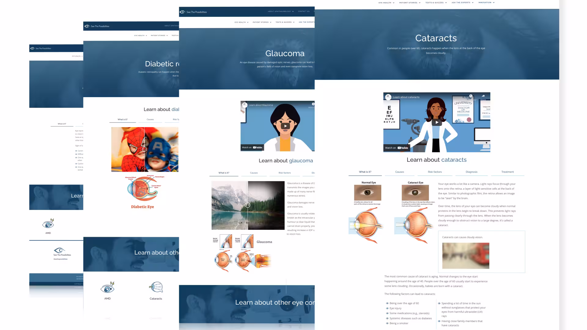 Composite image showing multiple mockups of an eye care educational website, including pages about diabetic eye disease, glaucoma, and cataracts with medical illustrations, diagrams, and informational sections.